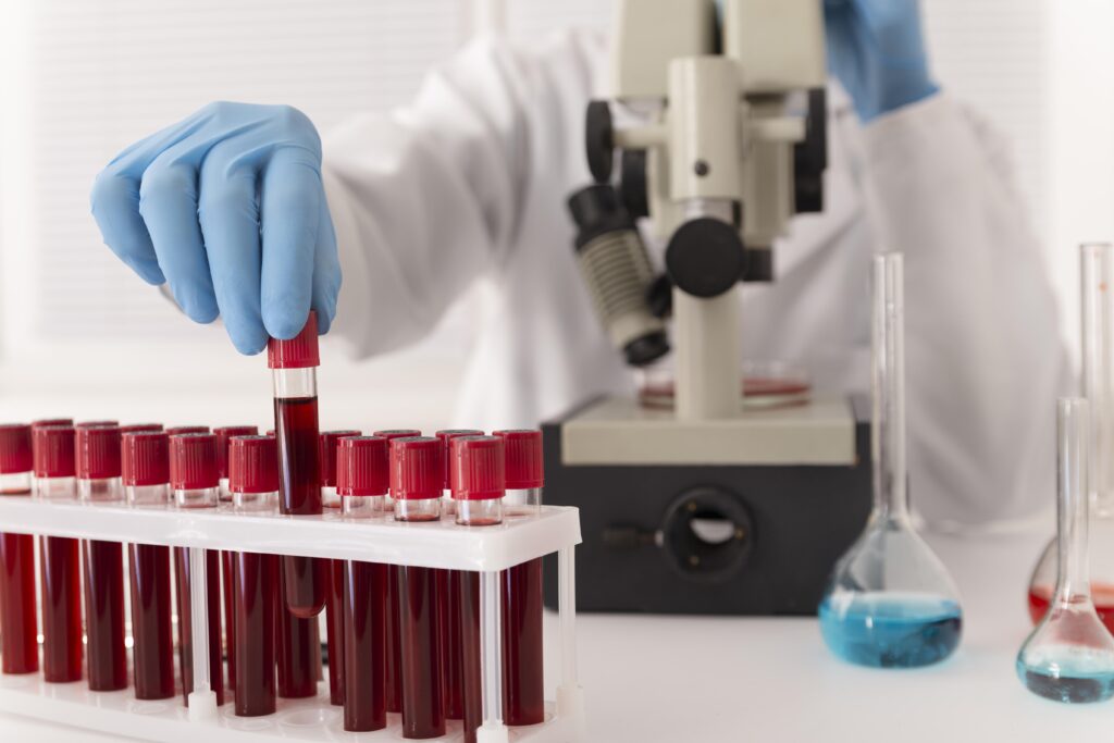 Identificação do Objeto Principal: Imagem de estúdio em close médio de um ambiente de laboratório de análises clínicas. Ação Central: Uma mão humana, usando uma luva de nitrilo azul-clara perfeitamente ajustada, está posicionada no centro da imagem. Os dedos polegar, indicador e médio estão segurando e retirando um tubo de ensaio (do tipo vacutainer) que contém sangue total colhido (líquido vermelho-escuro e opaco). O tubo possui uma tampa de segurança na cor vermelha vibrante, visivelmente estriada. Outros Elementos de Primeiro Plano: O tubo que está sendo removido faz parte de uma fileira frontal completa em um rack de laboratório de plástico branco. O rack tem múltiplas fileiras de tubos de ensaio, todos idênticos, preenchidos com sangue total e fechados com tampas vermelhas, criando uma linha de repetição visual. À direita, fora do rack principal, há dois frascos volumétricos de vidro de bases arredondadas, contendo líquidos azuis e vermelhos translúcidos. Elementos de Fundo: No fundo, desfocado (efeito bokeh profundo), vê-se a figura de uma pessoa vestindo um jaleco de laboratório branco (provavelmente a pessoa cuja mão está em primeiro plano). A pessoa está posicionada atrás de um microscópio composto binocular clássico de laboratório (cor cinza e preto). O ambiente de fundo sugere uma bancada limpa e persianas de janela verticais brancas. Composição e Luz: Foco nítido na mão e nos tubos centrais. A iluminação é suave, frontal e uniforme, típica de um ambiente médico limpo. Marcas/Texto: Não há logotipos visíveis ou texto legível, apenas as texturas das tampas vermelhas e do sangue nos tubos.